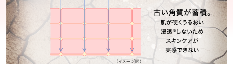 古い角質が蓄積。
肌が硬くうるおい浸透しないためスキンケアが実感できない